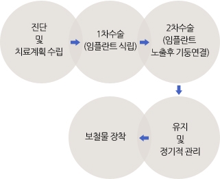 진단 및 치료계획수립 > 1차수술(임플란트 식립) > 2차수술(임플란트 노출후 기둥연결) > 유지 및 정기적 관리 > 보철물 장착