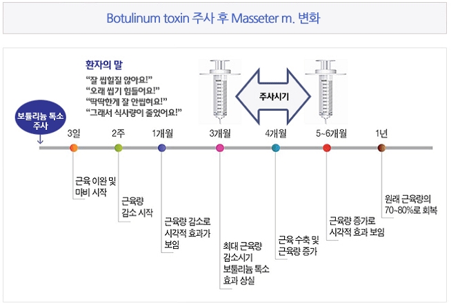 3일 : 근육 이완및 마비시작 ~ 2주 : 근육량 감소시작 ~ 1개월 : 근육량 감소로 시각적 효과가 보임 ~ 3개월 : 최대근육량 감소시기 보툴리늄 톡소 효과 상실 ~ 5-6개월 : 근육량 증가로 시각적 효과 보임 ~ 1년 : 원래 근육량의 70% - 80%로 회복